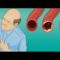 ?  20 Foods That Will Clean Your Arteries Naturally And Protect You From Heart Attacks